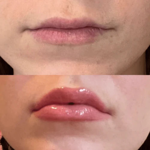 <tc>Lip Plumper</tc>