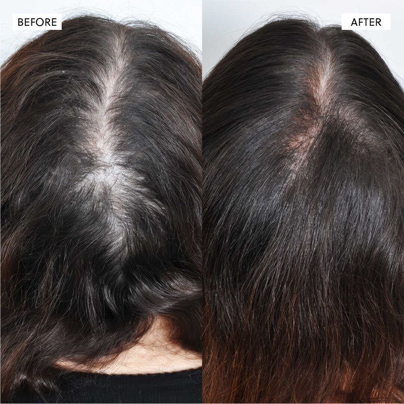 Hair Growth Accelerator