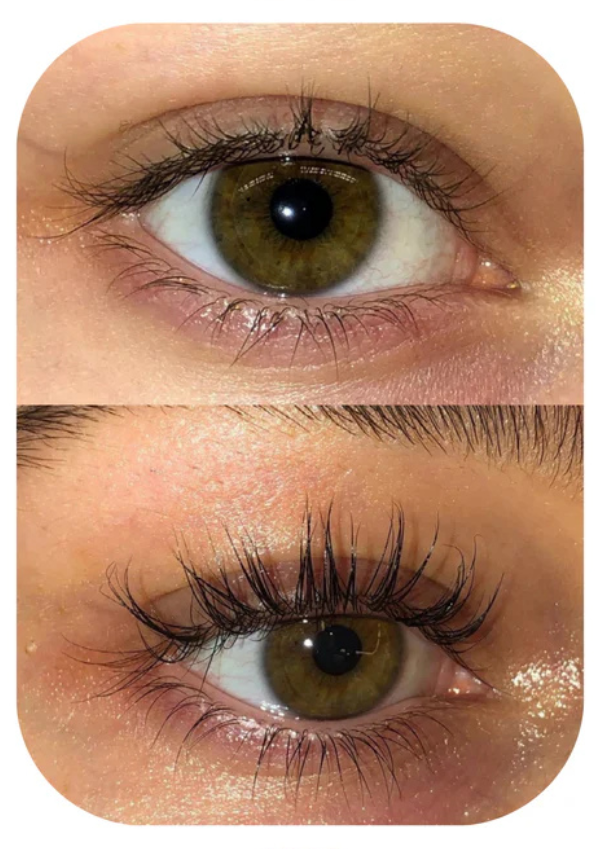 Tilt serum