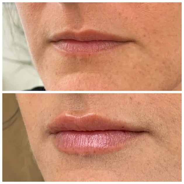 <tc>Lip Plumper</tc>