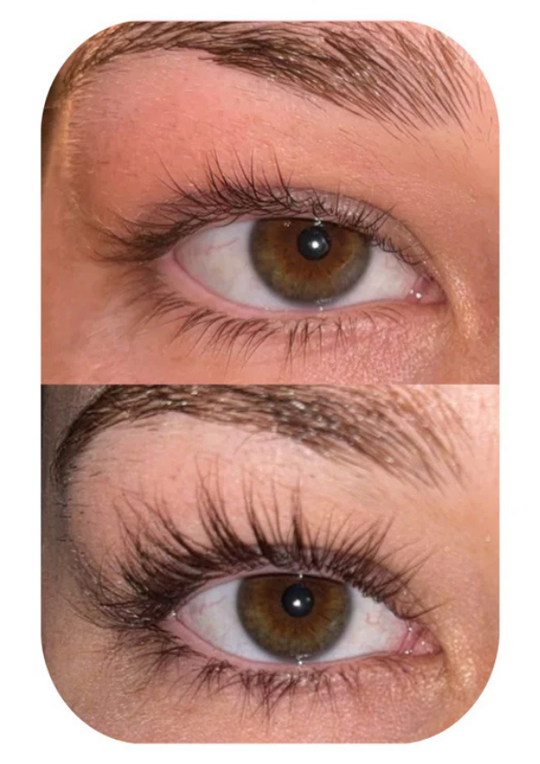 Tilt serum