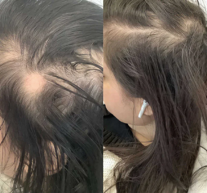 Hair Growth Oil Spray