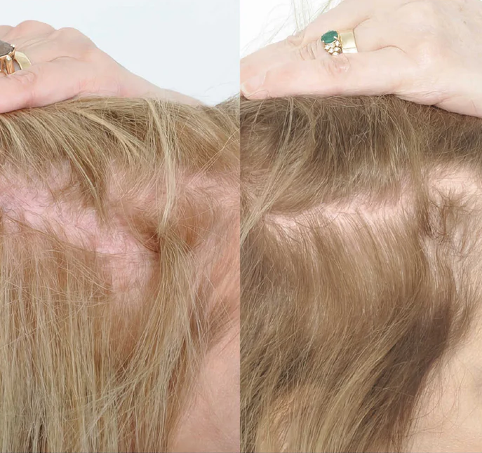 Hair Growth Oil Spray