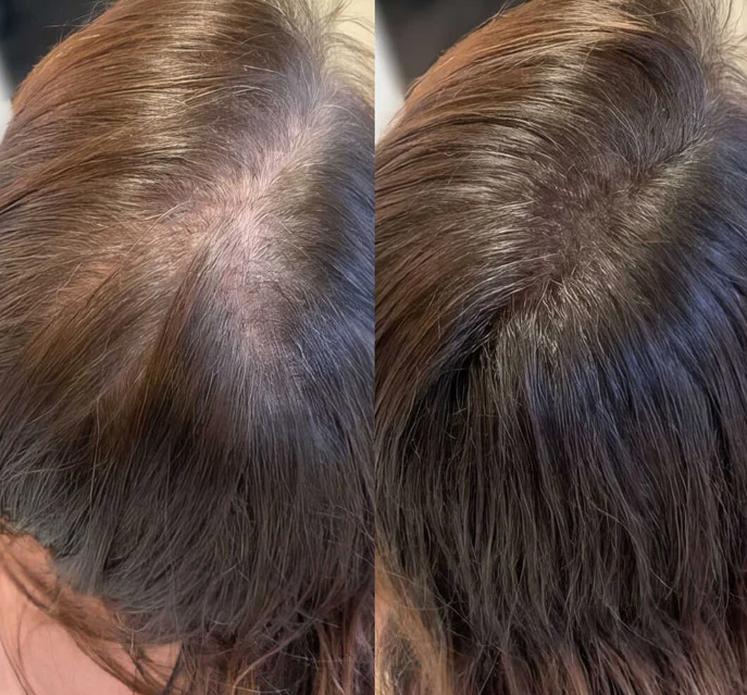 Hair Growth Oil Spray